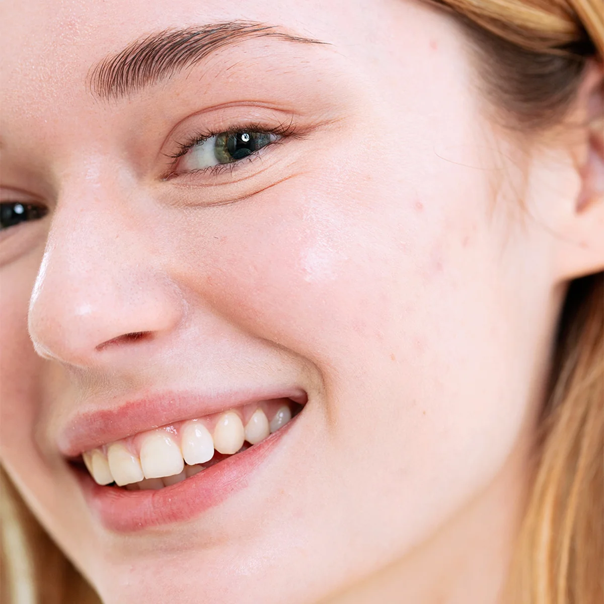 SEBIACLEAR Creme SPF50+ - Image 3